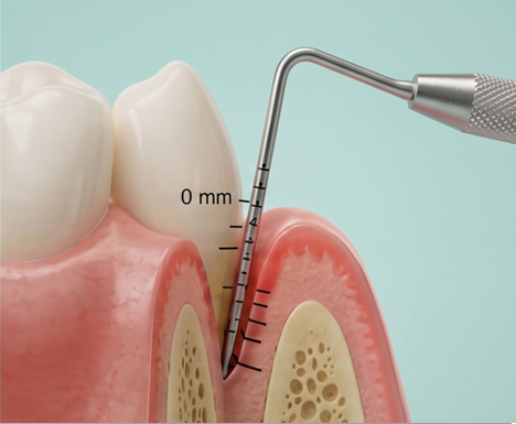 Periodoncia